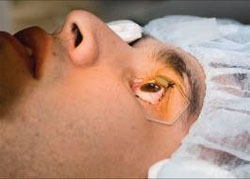 Is Eye Surgery Painful